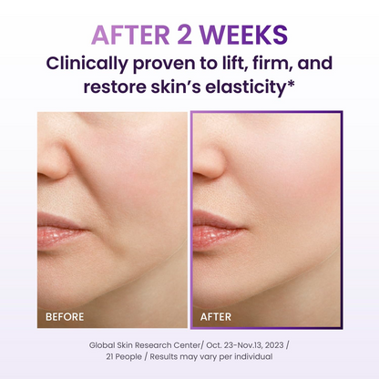Probioderm™ 3D Lifting Cream